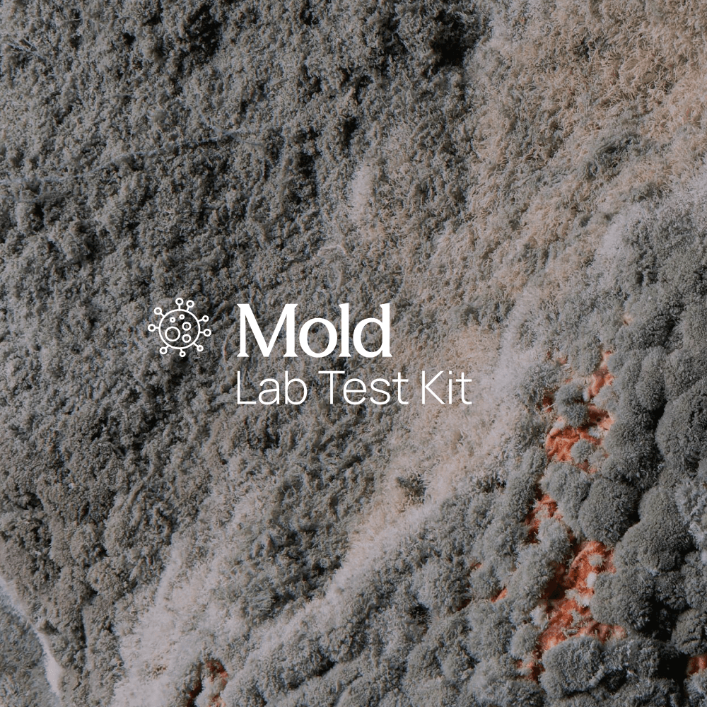 RUSH: Mold and Fungus Surface Swab Test